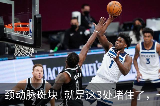 颈动脉斑块 就是这3处堵住了，一旦疏通头晕失眠乏力改善是很快的